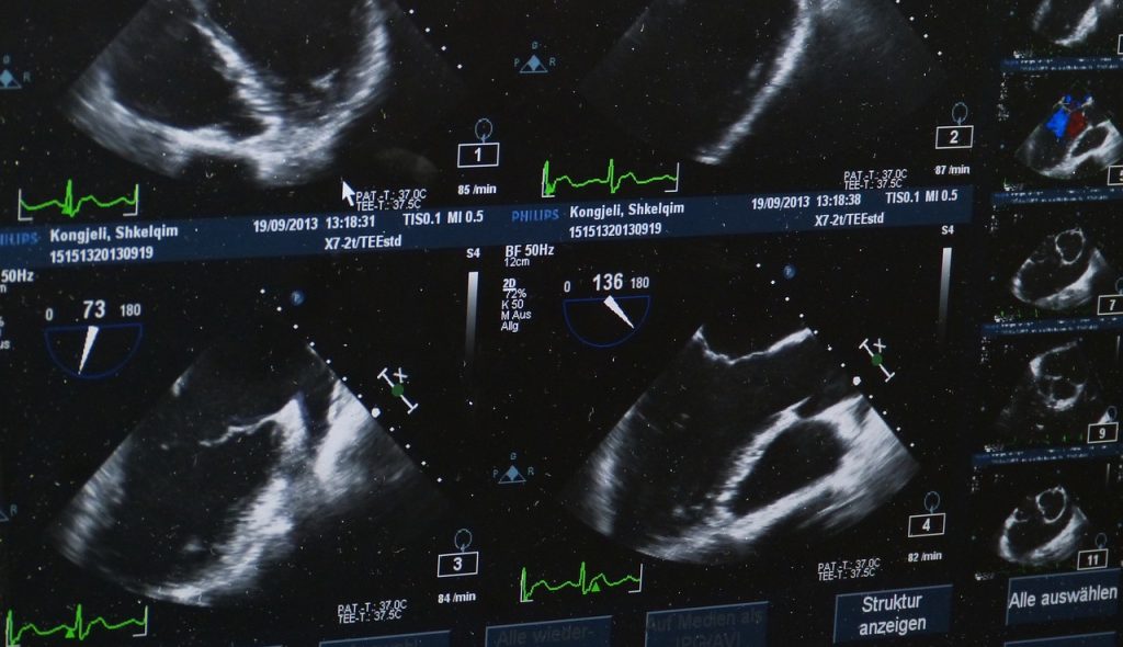 ultrasound-509396_1280